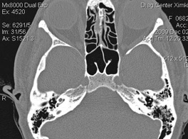 Tomografia computerizată multispirală este centrul medicinei de familie 