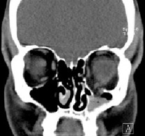 Tomografia computerizată multispirală este centrul medicinei de familie 