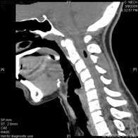 Tomografia computerizată multispirală este centrul medicinei de familie 