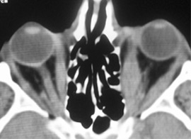 Tomografia computerizată multispirală este centrul medicinei de familie 