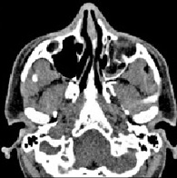 Tomografia computerizată multispirală este centrul medicinei de familie 