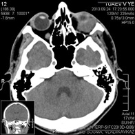 Tomografia computerizată multispirală este centrul medicinei de familie 