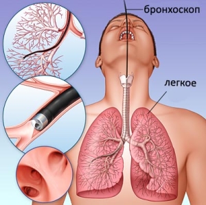 Tisztító a tüdőben a dohányos emberek jogorvoslatok otthon