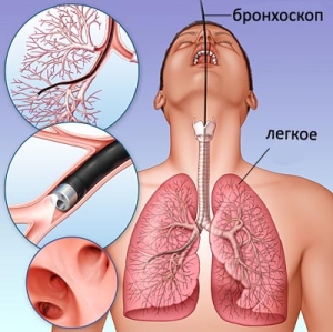 Curățarea plămânilor unui fumător cu remedii folk la domiciliu