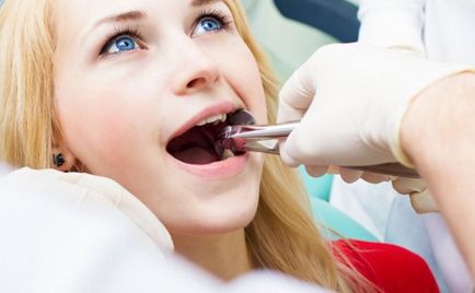 Absența dinților din primele 8 consecințe negative, sanationarea clinică