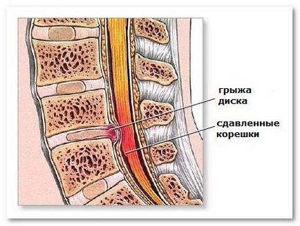 Нирка латинською на