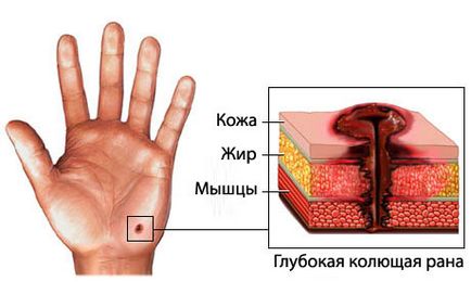 Cuts - prezentare generală - portal medical eurolab