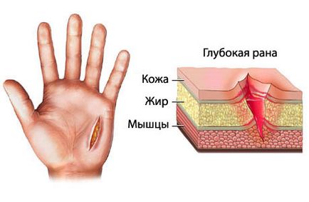 Cuts - prezentare generală - portal medical eurolab