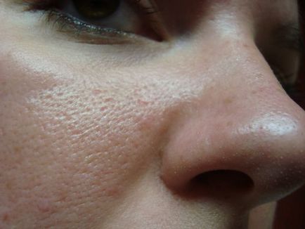 A porózus bőr arckezelés otthon, fotó, mit maszkokat kell használni, video tippek