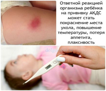 Complicațiile post-vaccinare la copii după accident sunt principalele evenimente din viața nou-născutului