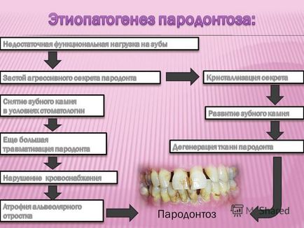 Előadás a parodontitis (speciális esetek) Előadás a fogágybetegség