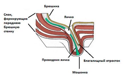 Cauzele căderii cauzate de caracteristicile anatomice ale apendicelui peritoneului