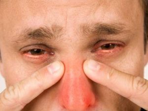Jelek az első tünetek arcüreggyulladás, ha fáj