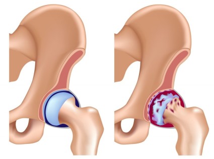 Semne de dislocare a traumaticii si congenitale