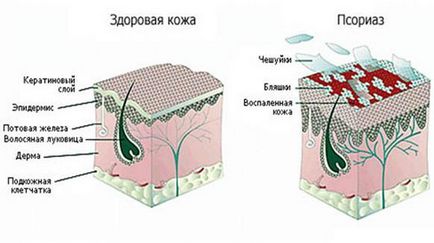 лущаться лікті