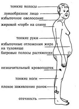 синдром кушинга