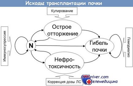 Сучасні можливості пересадки органів