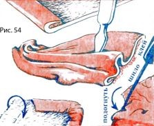 Способи обробки шкіри - Жмурка (драпірування шкіри)