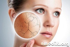 Суха шкіра обличчя - правила догляду