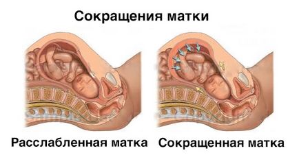 Тонус матки при вагітності, можливо визначити в домашніх умовах