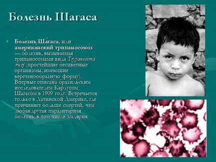 Трипаносома що це, життєвий цикл, місце проживання, стадії розвитку, причини та симптоми