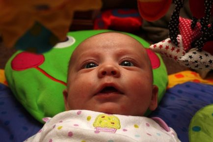 У новонародженого косять очі причини та можливі наслідки