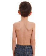 Exerciții pentru postură corectă, cum să alegeți un corector pentru corectarea posturii la un copil