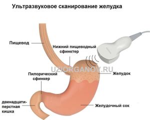 Узі шлунка що показує і як робиться