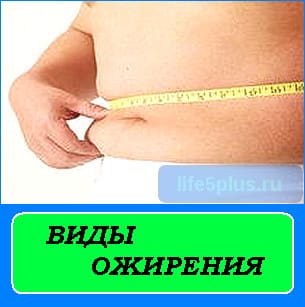 Tipuri de obezitate