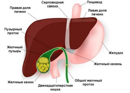 Toate bolile vezicii biliare