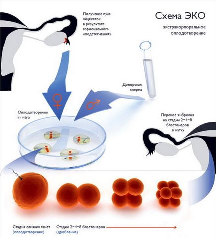 Tratamentul endometritelor cronice, semne, merită să utilizați eco-ul