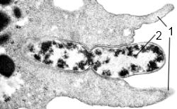 Dysenteria amoeba, proteine ​​comune, intestinale, amoeba