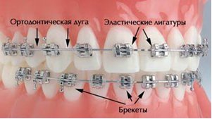 Ce este un sistem de ancorare sau suport, policlinică dentară gauză № 9 g