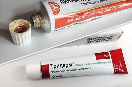 Ефективні мазі для лікування циститу