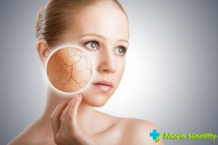 Glicerin és E-vitamin - egy gazdaságos módja annak, hogy fiatalító és gyógyító a bőrrel (krémek maszkok) Glicerin és E-vitamin - egy gazdaságos módja annak, hogy fiatalító és gyógyító a bőrt