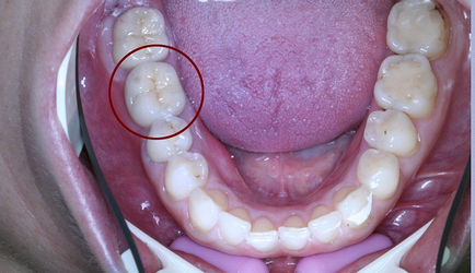 Implantológia Moszkva, egészségügyi központ szolgáltatások Kolomna ( „CIP”)