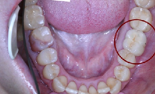 Implantológia Moszkva, egészségügyi központ szolgáltatások Kolomna ( „CIP”)