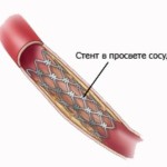 Які вітаміни для серця краще