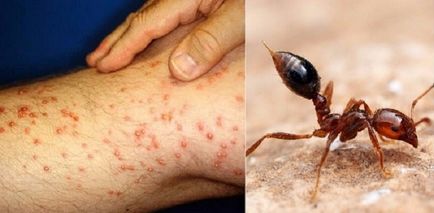 Modul de a distinge o mușcătură a unei insecte de o boală gravă este determinată cu ochiul liber