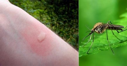 Як відрізнити укус комахи від серйозного захворювання визначаємо неозброєним оком