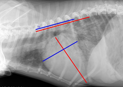 Indicele cardiovertebral ca modalitate obiectivă de evaluare a dimensiunii siluetei cardiace cu un toracic