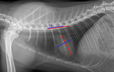 Indicele cardiovertebral ca modalitate obiectivă de evaluare a dimensiunii siluetei cardiace cu un toracic