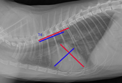 Indicele cardiovertebral ca modalitate obiectivă de evaluare a dimensiunii siluetei cardiace cu un toracic