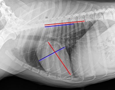 Indicele cardiovertebral ca modalitate obiectivă de evaluare a dimensiunii siluetei cardiace cu un toracic