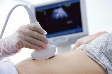 Кіста при вагітності на ранніх термінах - методи лікування
