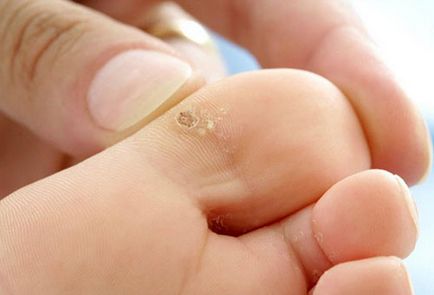Шкірні захворювання на ногах - як не допустити їх появи, і в чому причина їх розвитку