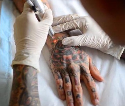 Sprâncenele roșii după tatuare