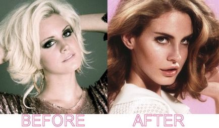 Lana del Rey înainte și după operațiuni, știri și fotografii 2017