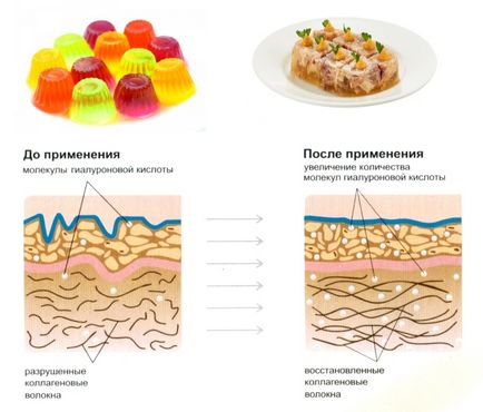 Kezelése gonarthrosis népi orvosság - hatékony módszereket