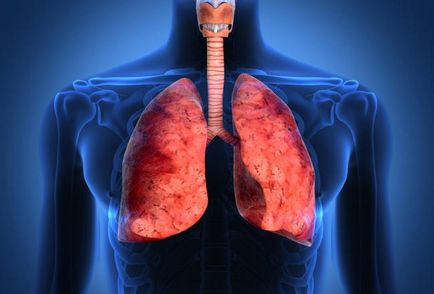 Tratamentul unei tumori pulmonare carcinoide în Israel